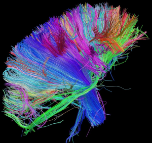White matter fiber architecture of the brain. Measured from diffusion spectral imaging (DSI). The fibers are color-coded by direction: red = left-right, green = anterior-posterior, blue = up-down. www.humanconnectomeproject.org